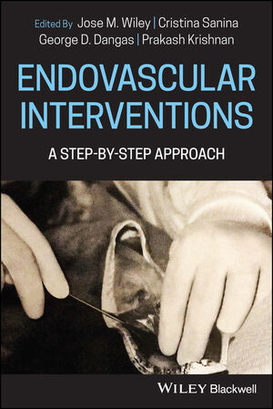 Endovascular Interventions: A Step-by-Step Approach