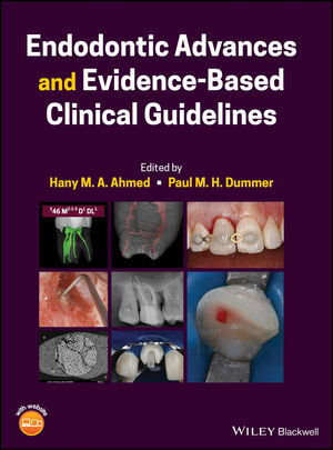 Endodontic Advances and Evidence-Based Clinical Guidelines | Wiley