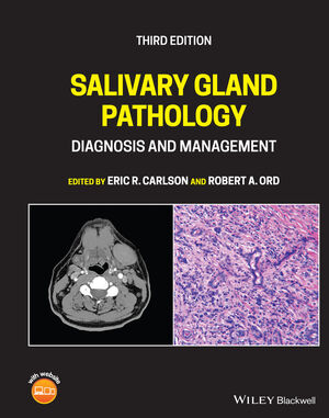 Salivary Gland Pathology: Diagnosis and Management, 3rd Edition cover image