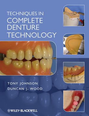 Techniques in Complete Denture Technology | Wiley