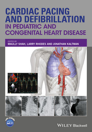 Cardiac Pacing and Defibrillation in Pediatric and Congenital Heart Disease (2017) (PDF) Maully Shah