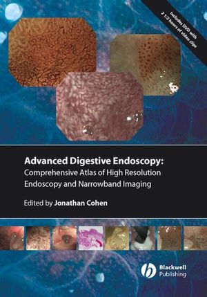 Comprehensive Atlas of High Resolution Endoscopy and Narrowband Imaging (2008) by Jonathan Cohen (Editor)