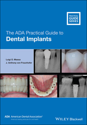 Clinical Periodontology and Implant Dentistry, 2 Volume Set
