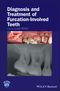 Diagnosis and Treatment of Furcation-Involved Teeth (1119270650) cover image